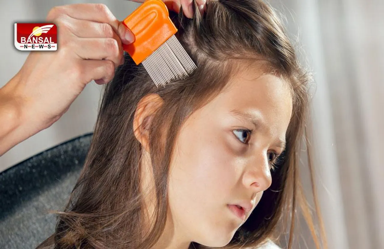 Lice: बालों से जूंए को दूर करने के आयुर्वेदिक उपाय क्या हैं?