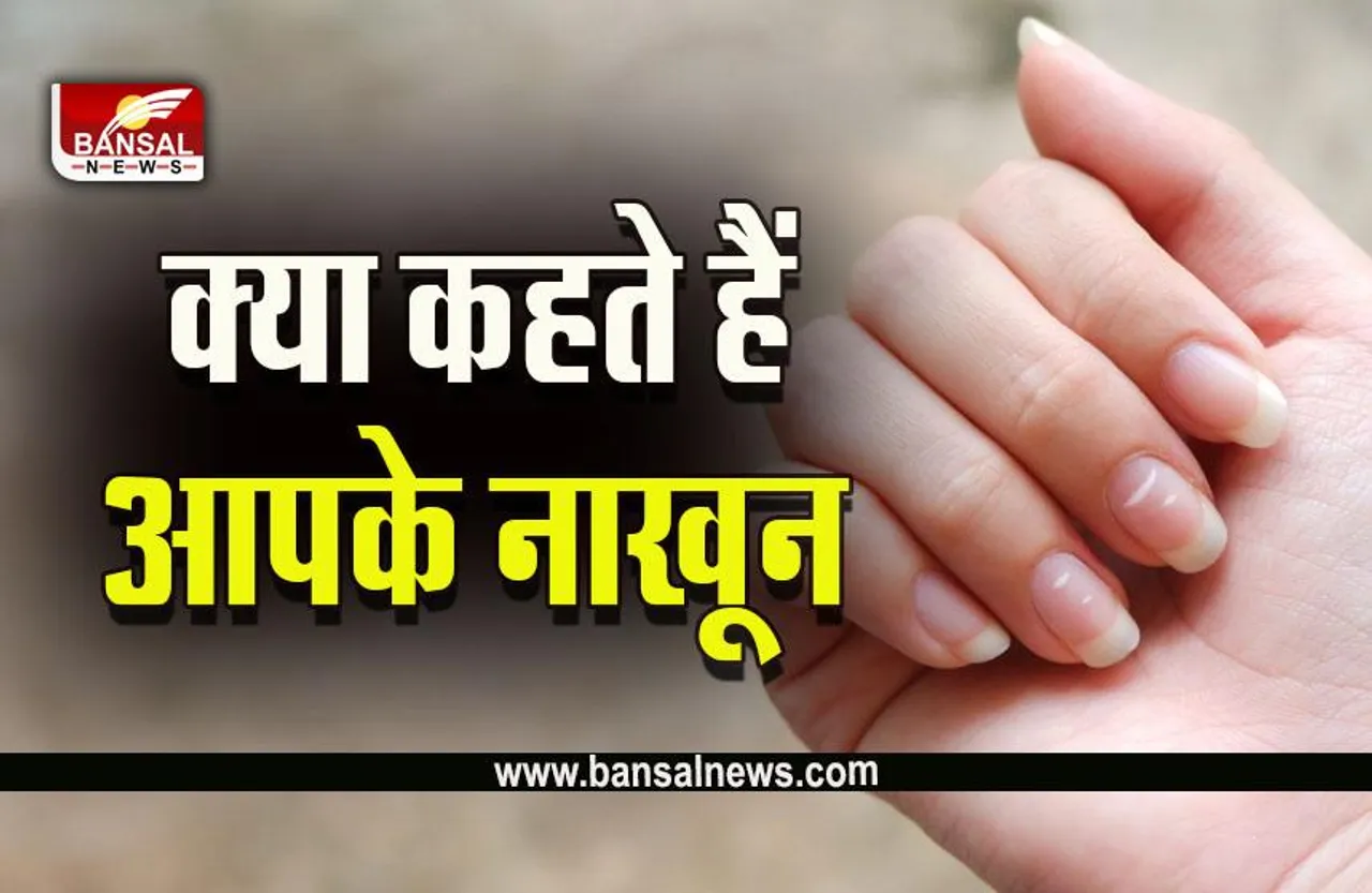 Black-White Spots On Nails : क्या सच में नाखूनों पर ये निशान वाले होते हैं लकी, क्या कहता साइंस, धार्मिक कारण