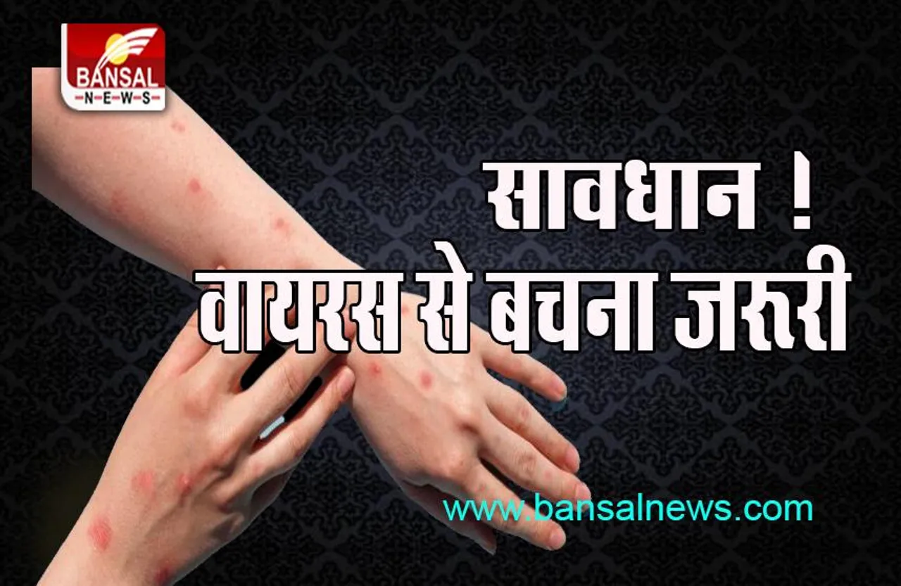 Delhi Monkeypox: डराने लगा वायरस का खतरनाक कहर, मिले 5 नए मामले