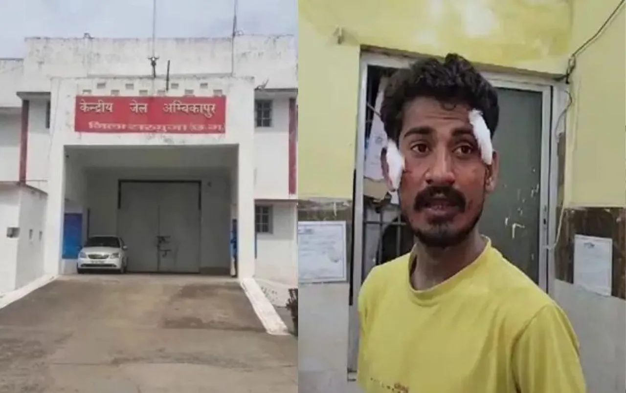 अंबिकापुर सेंट्रल जेल में कैदियों के बीच विवाद: एक कैदी ने दूसरे बंदी पर ब्लेड से किया हमला, इस बात को लेकर किया अटैक