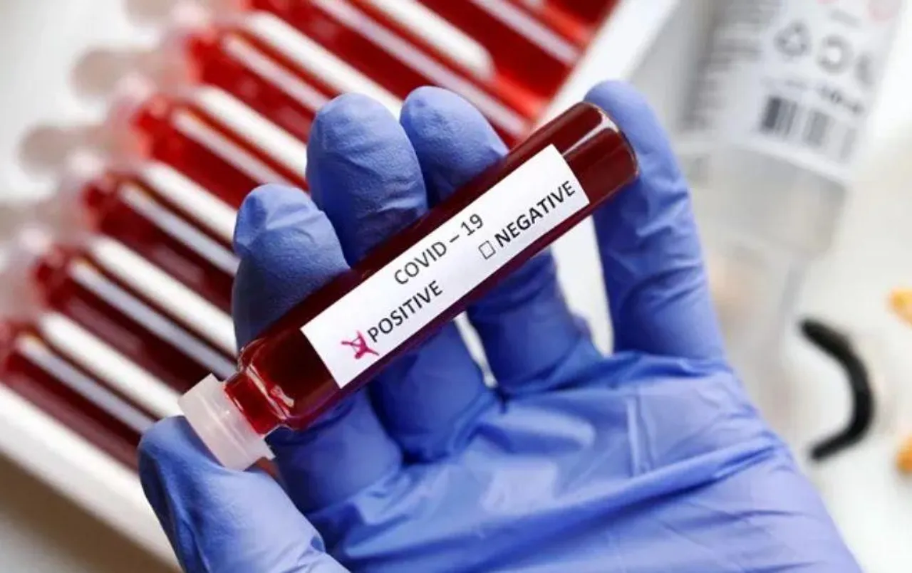 CG News: बिलासपुर जिले में कोरोना का मरीज मिला; स्वास्थ्य विभाग में हड़कंप, डायरिया और मलेरिया भी बढ़ा रहे चिंता