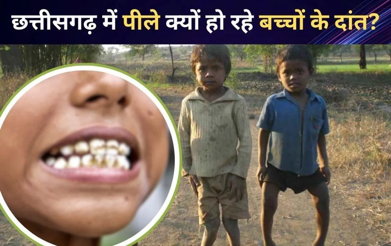 छत्तीसगढ़ के इस जिले में डेंटल फ्लोरोसिस का शिकर हो रहे बच्चे: इस बीमारी को कंट्रोल करने के लिए लगाए गए प्लांट हुए बंद