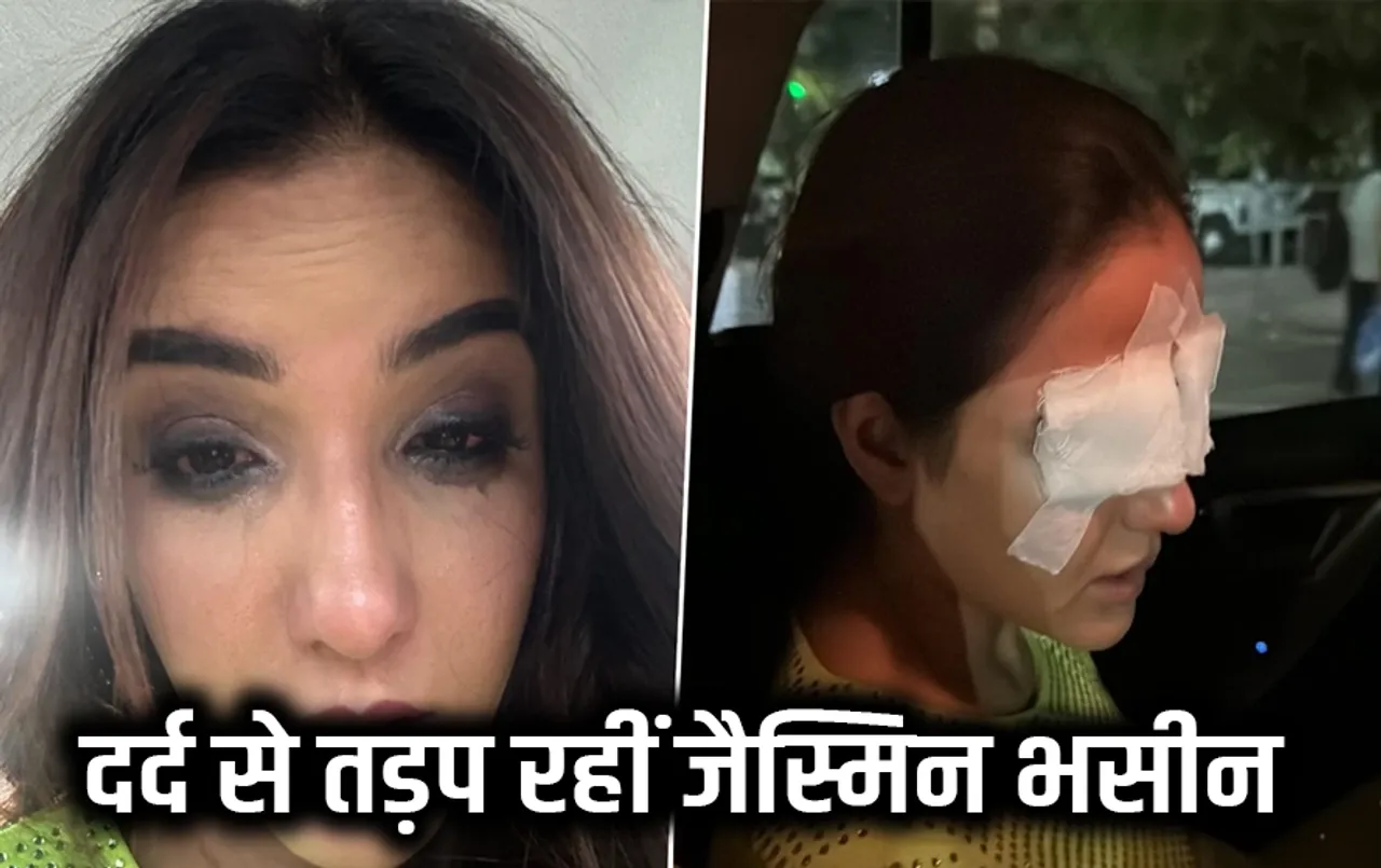 Jasmine Bhasin Eye Cornea: जैस्मीन भसीन को कांटेक्ट लेंस की वजह से आँख से दिखना हुआ बंद, एक्ट्रेस ने शेयर की तस्वीरें