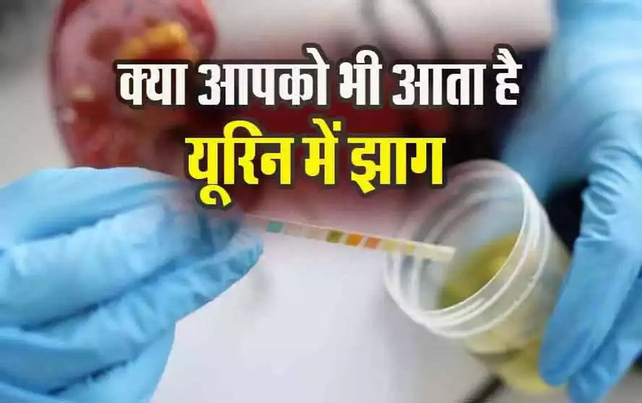 Urine me Jhag ka Karan: कहीं आपको भी तो नहीं आता यूरिन मे झाग, हो सकता है खतरनाक बीमारियों का संकेत, जानें कारण और उपाय