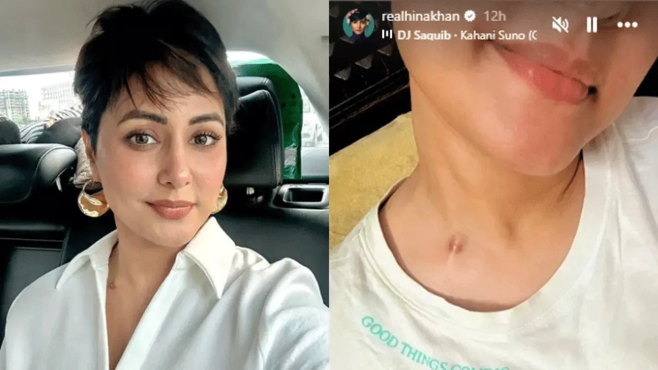 Hina Khan proudly flaunts her chemotherapy scars, fans praise her!