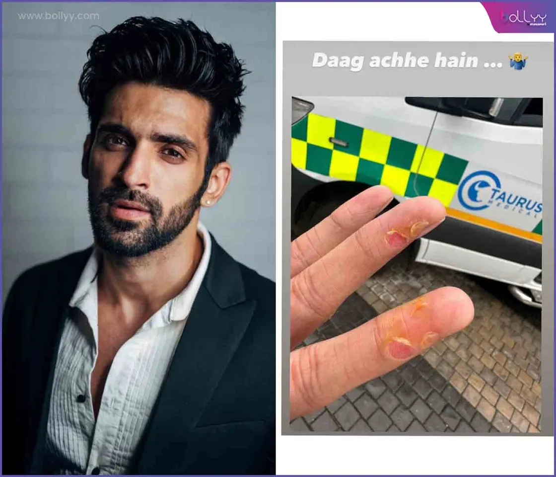 Arjit Taneja injury