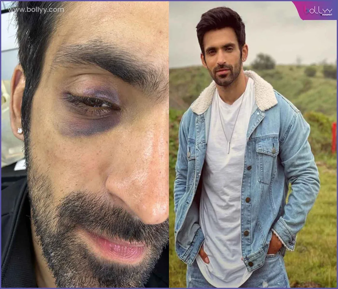Arjit Taneja gets injured