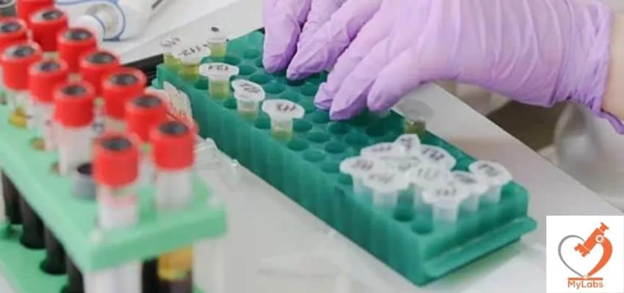 MyLabs Coronavirus test kit