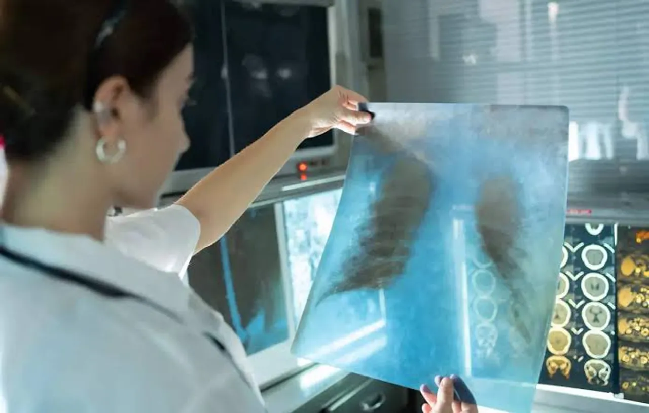 India develops indigenous hand-held X-ray for TB screening