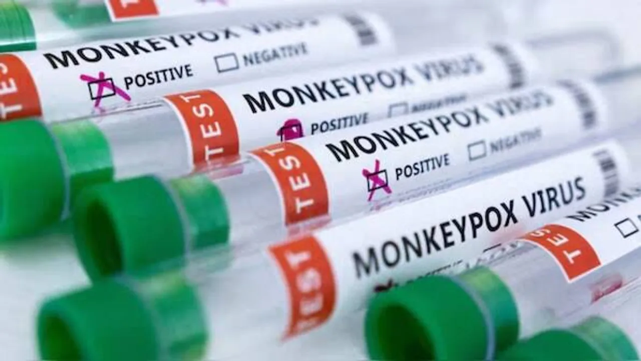 After Sweden case, China to screen arrivals for mpox symptomsI
