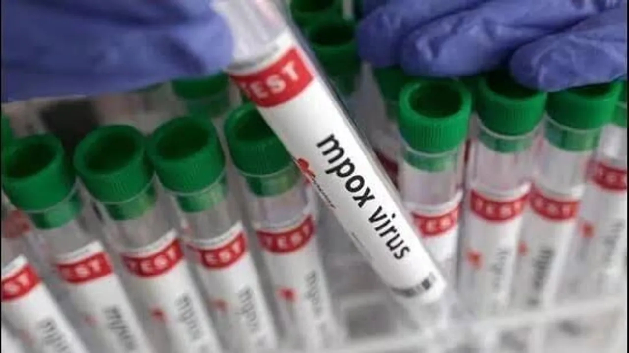 CDSCO approves indigenous Mpox RT-PCR test