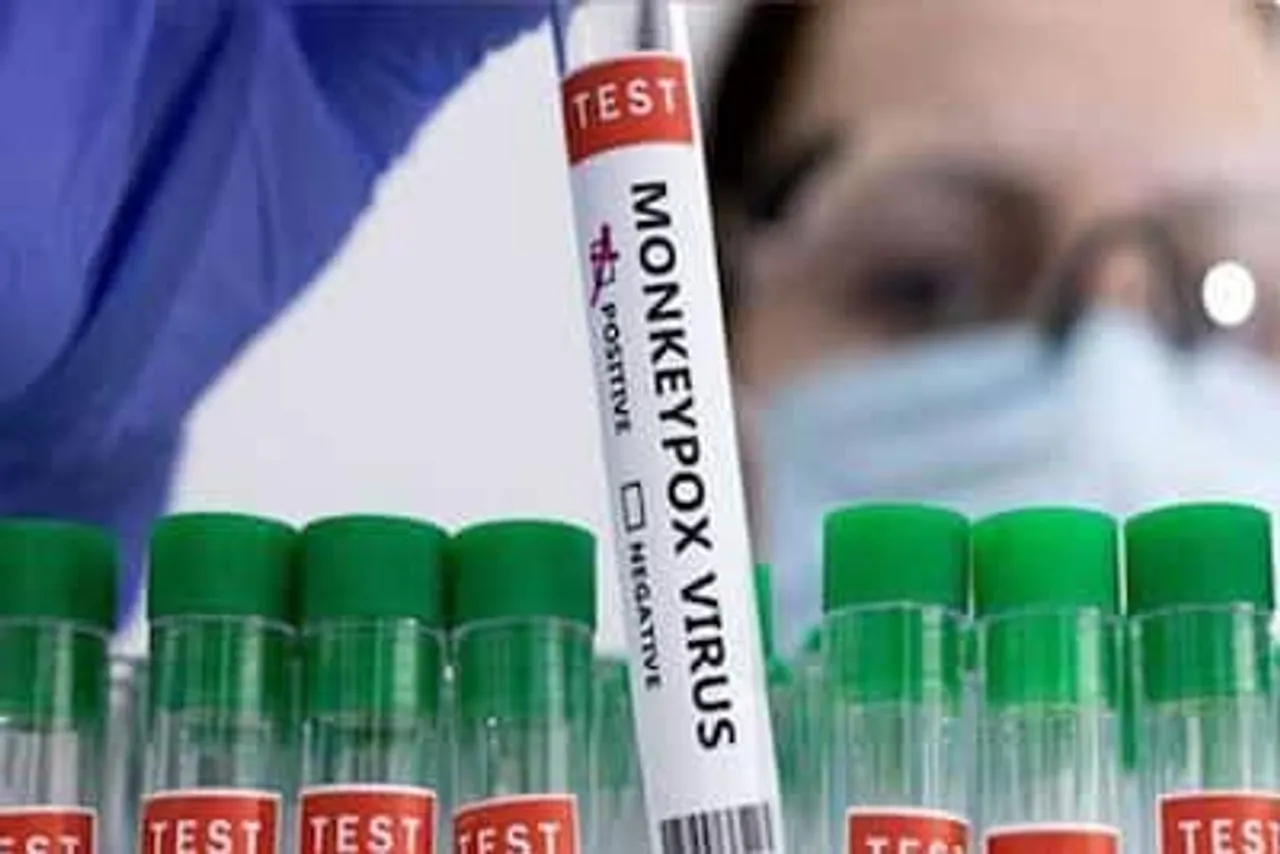 Monkeypox outbreak: WHO calls emergency meeting to assess global concern