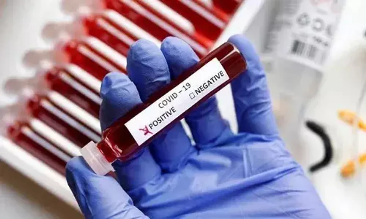Covid 19 cases reached 71910 in Vadodara after 3 new cases on Monday