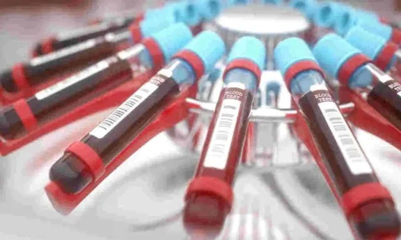 Thalassaemia girl's death in Rajkot triggers uproar