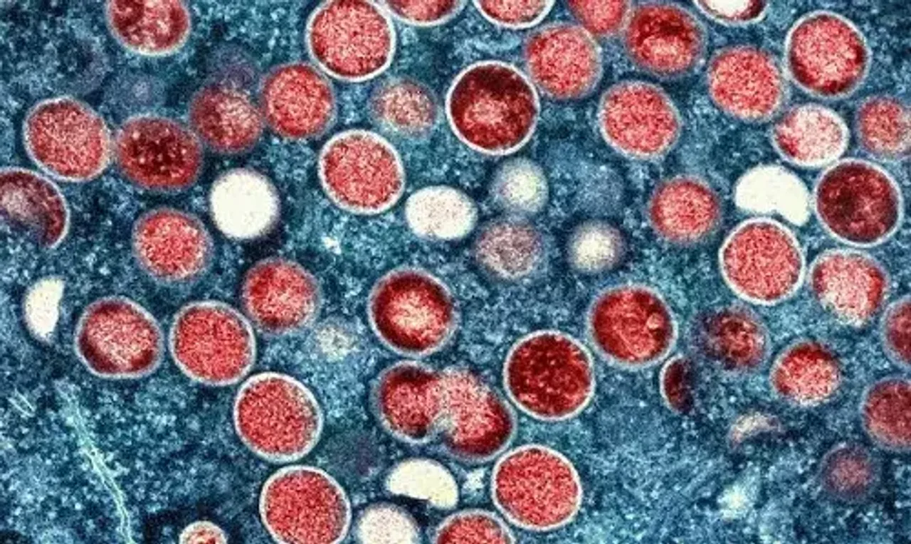 China Mpox cases surge as virus spreads to more parts of country