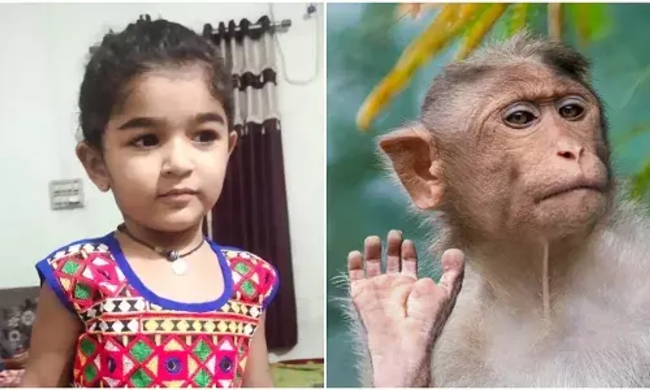 Three and half year old girl recieved 60 stitches after bitten by monkey in Ajod village near Vadodara