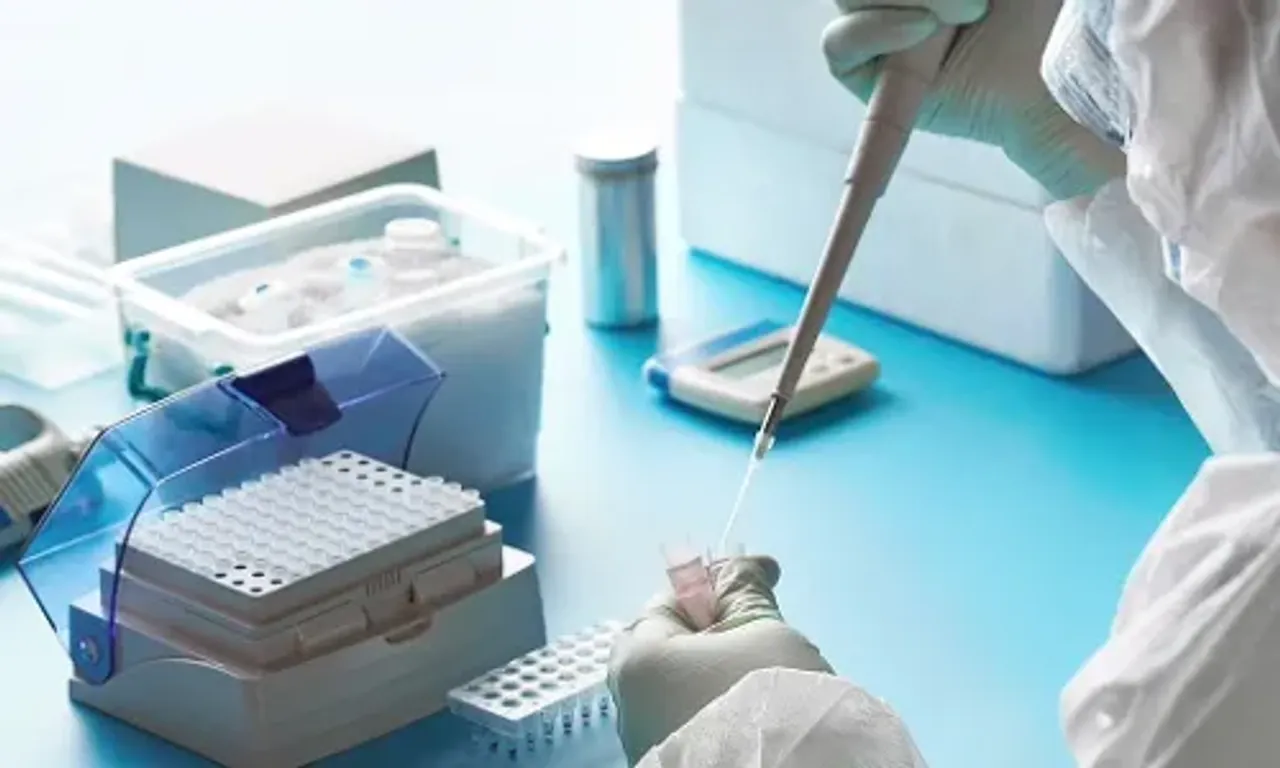 Zoonotic diseases area of concern: Union health secretary