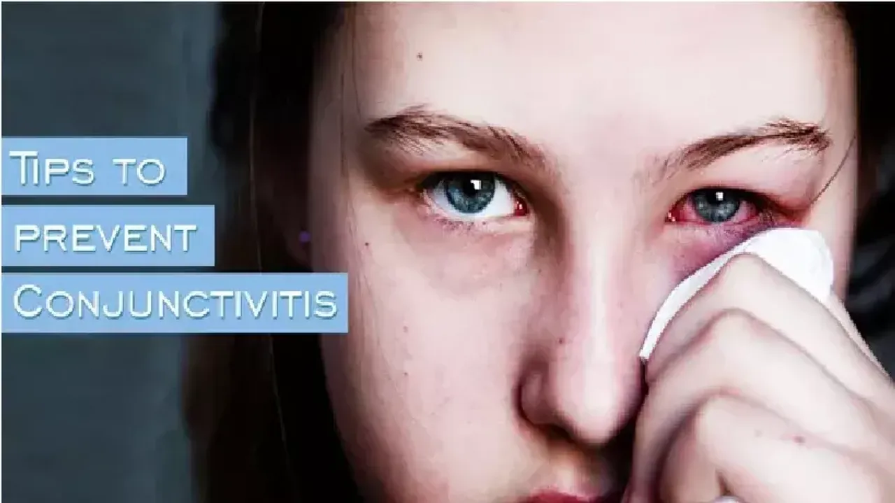 7 Easy Ways To Prevent 'Conjunctivitis'
