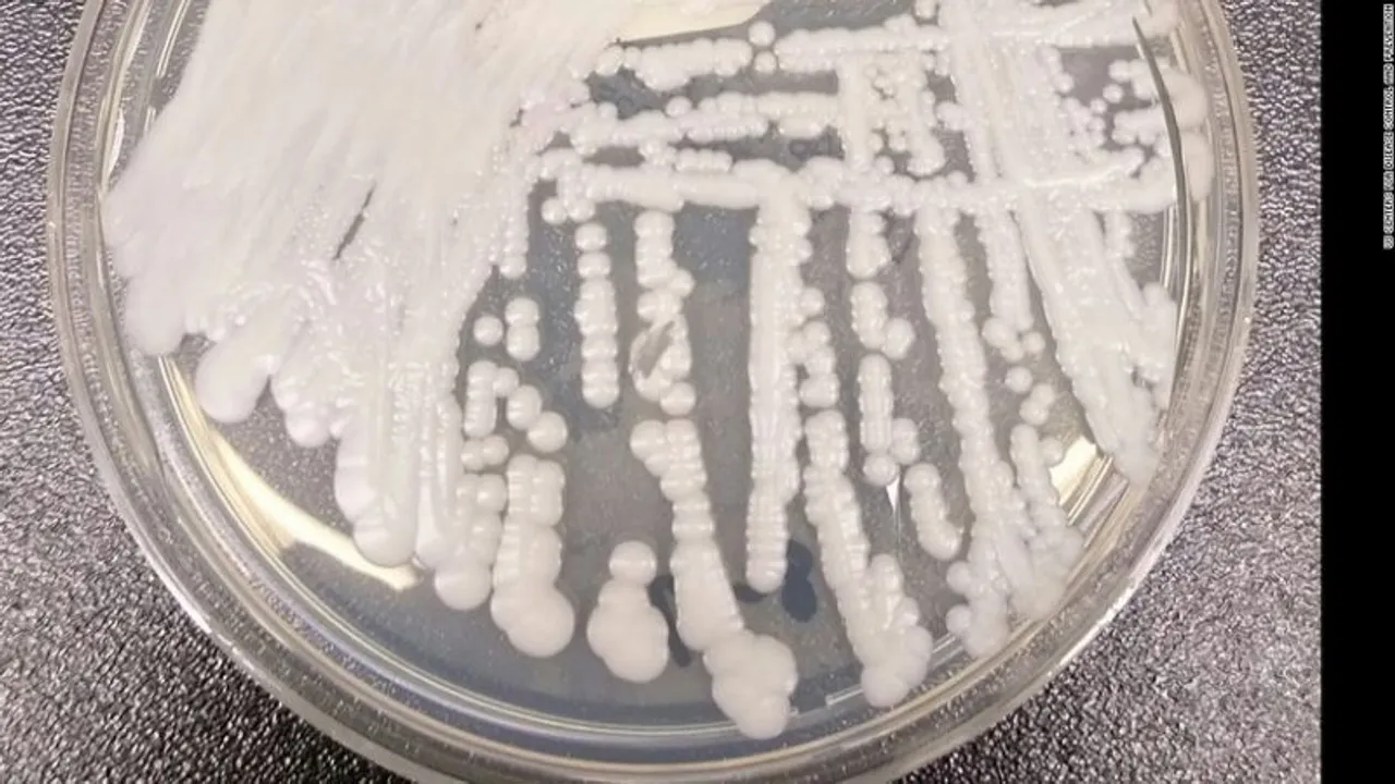 First drug-resistant fungal infections identified in US
