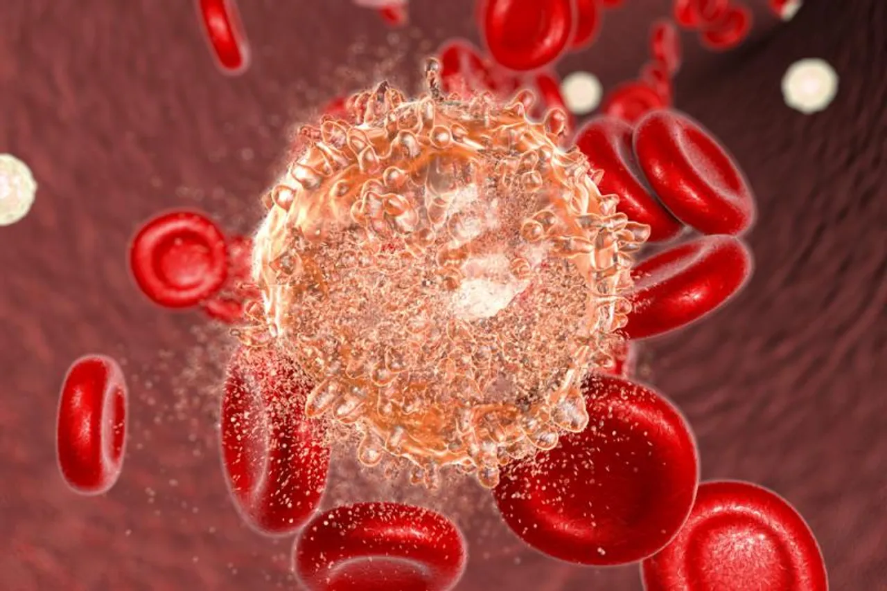 Obesity-associated protein promotes leukemia development