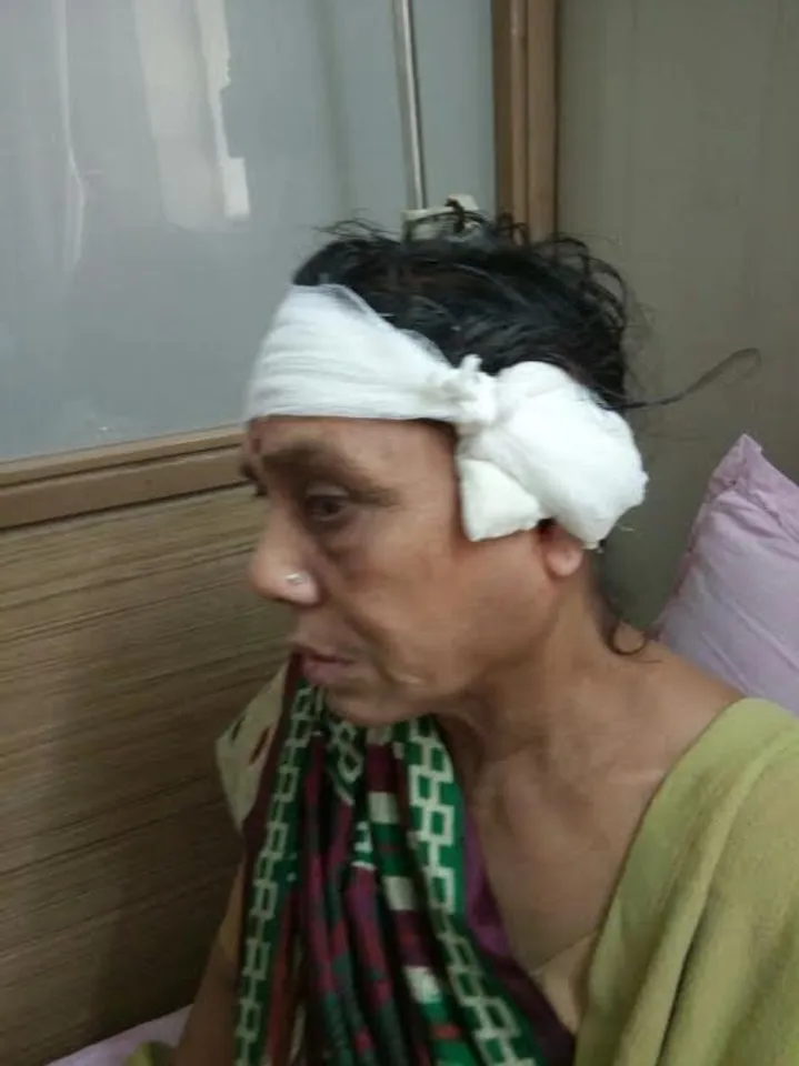 Robbers strike early morning injuring a women in Vadodara
