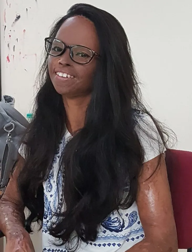 It was the darkest day in my life when the boy attacked me and threw acid on me : Laxmi Saa