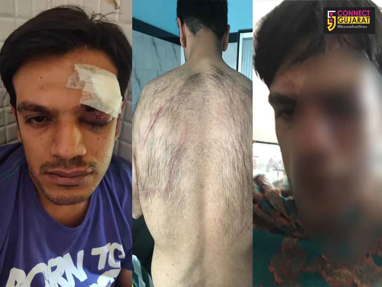 Memon family from Vadodara attacked in Lonavala