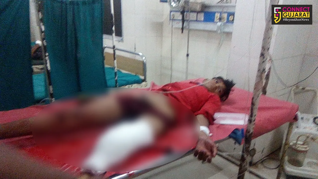 Tribal youth lost in leg after pushed out of running train