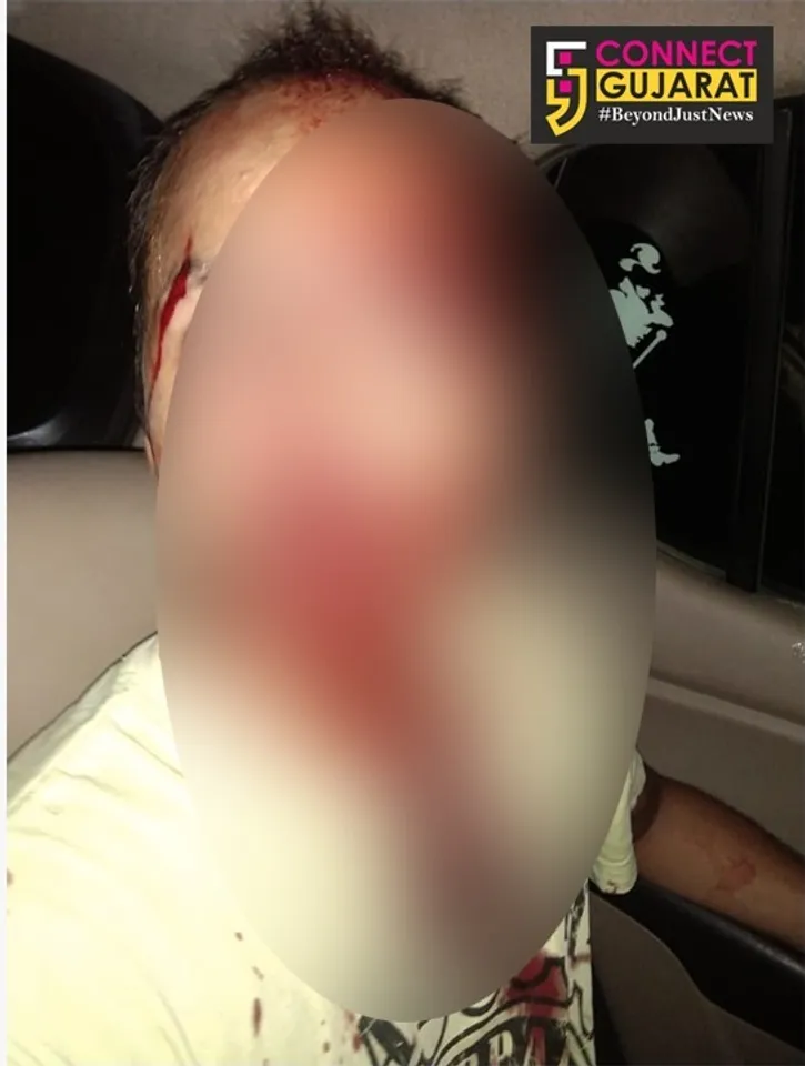 Four foreign students hit and greviously injured society committee member