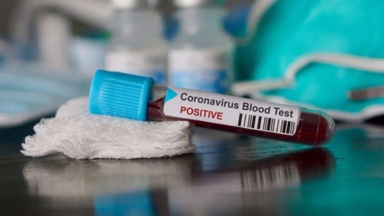 Second Corona positive case in Vadodara