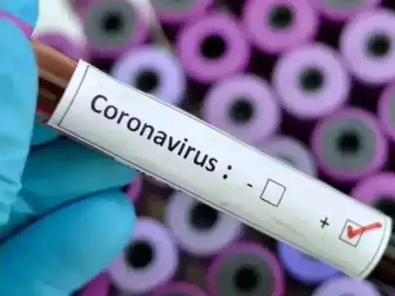 Two persons tested positive of Coronavirus in Vadodara
