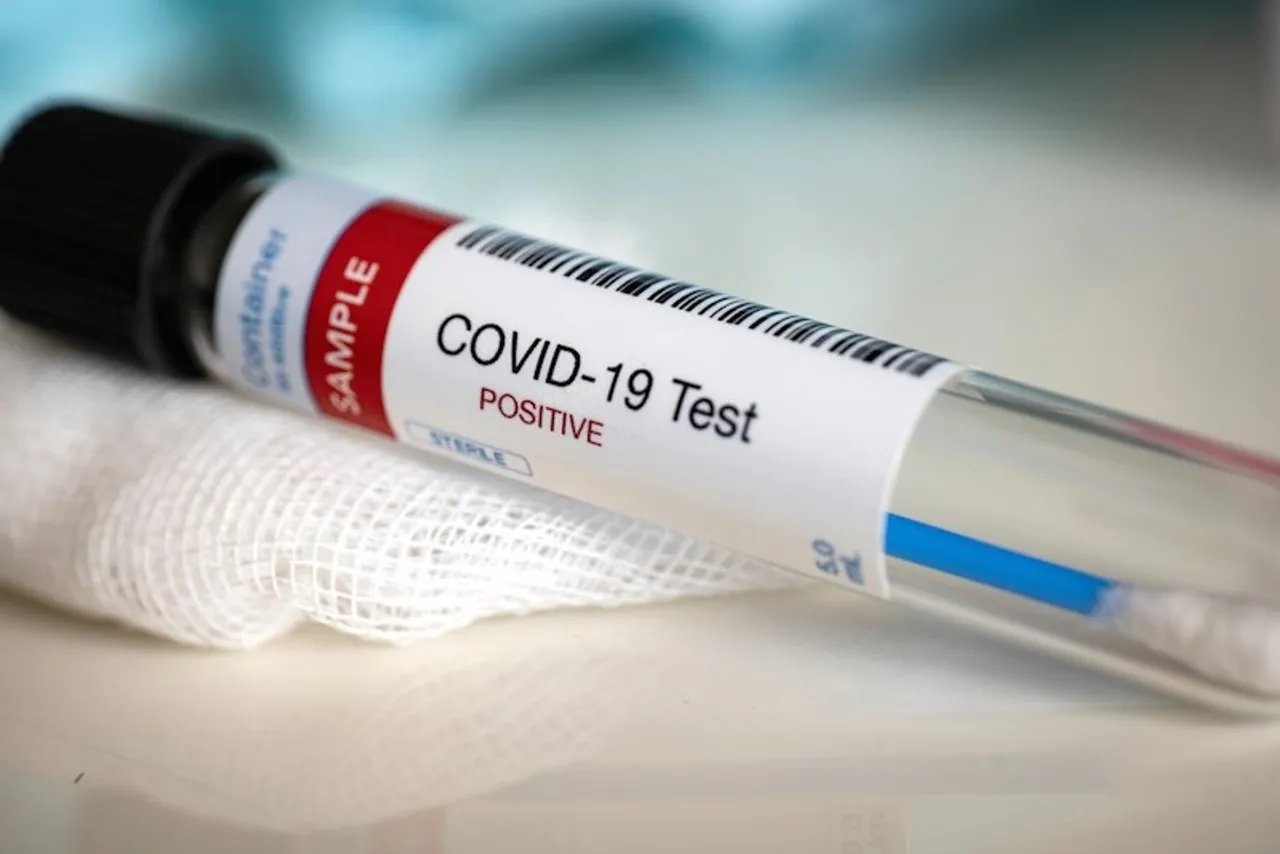 Covid 19 cases rise to 933 in Vadodara after 29 new cases on Wednesday