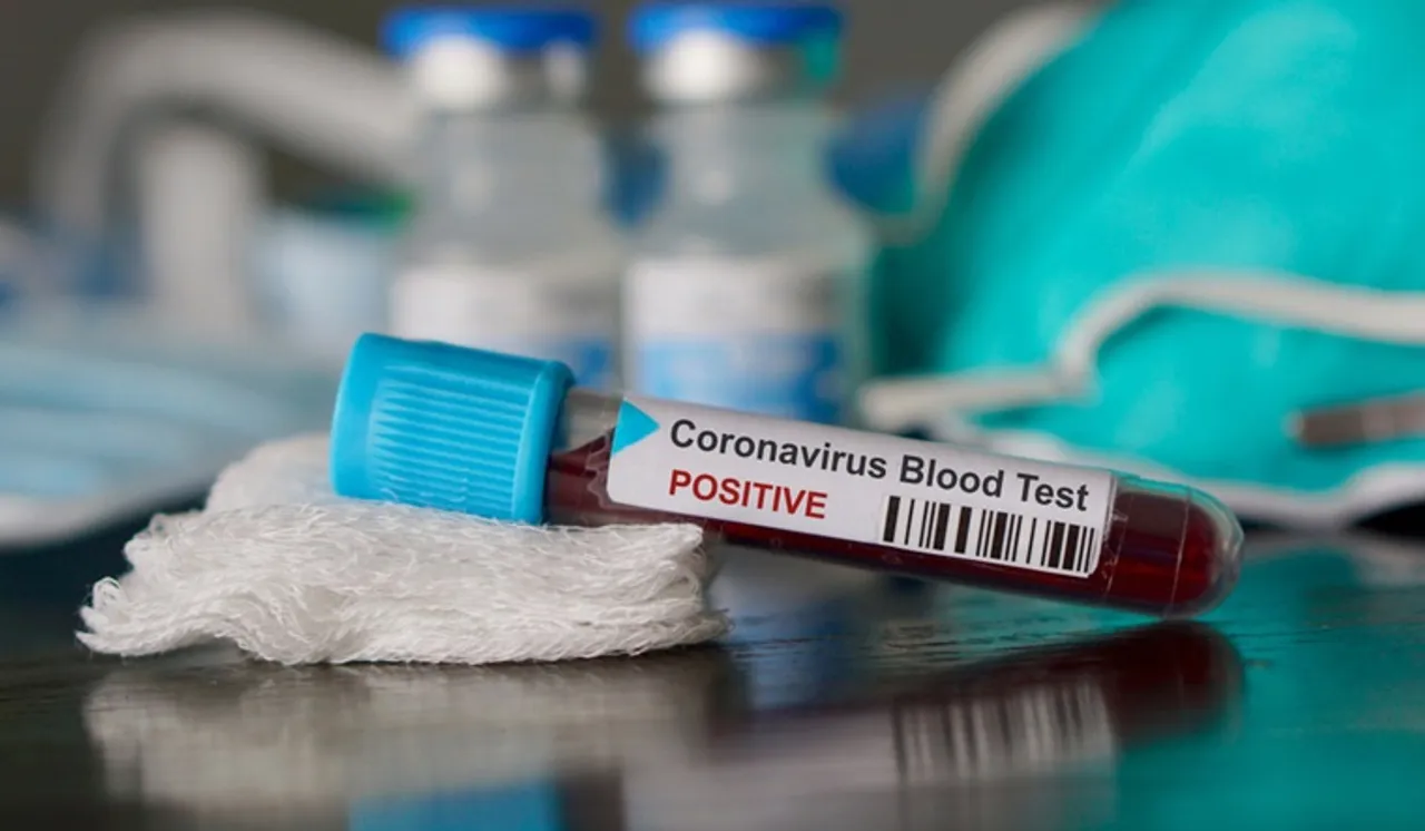 Covid 19 cases rise to 1953 in Vadodara after 42 new cases on Tuesday