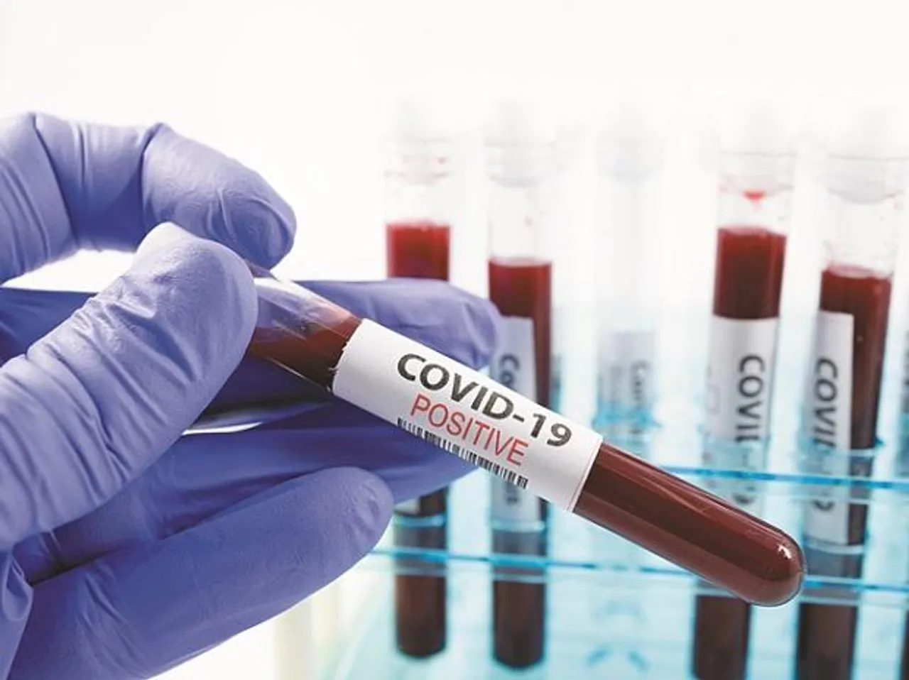 Covid 19 cases reached 3143 in Vadodara after 74 new cases on Monday
