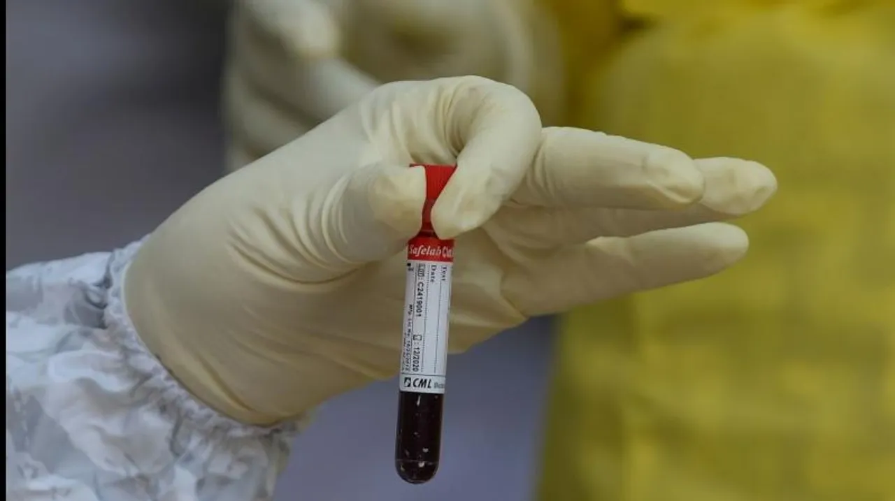 Covid 19 cases reached 4010 in Vadodara after 91 new cases on Friday