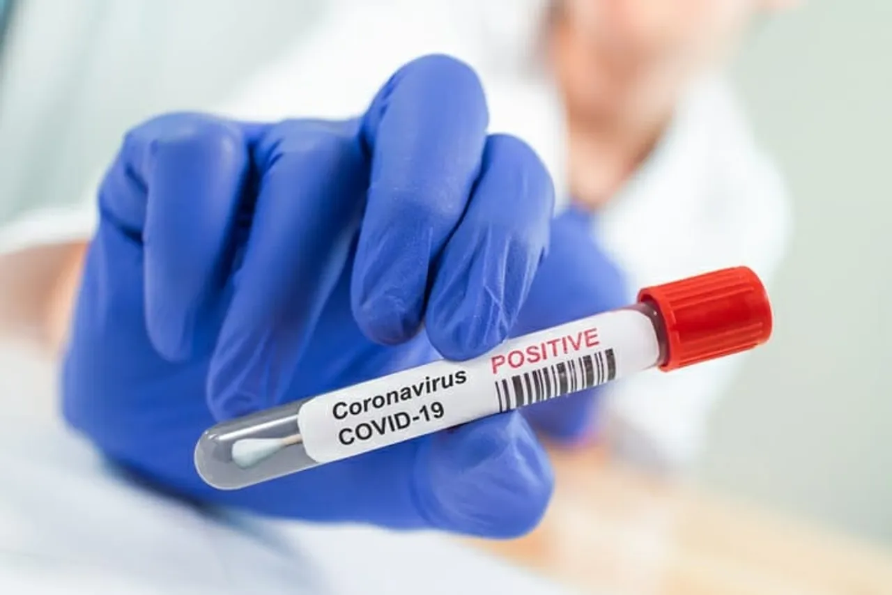 Covid 19 cases reached 13597 in Vadodara after 107 new cases on Friday