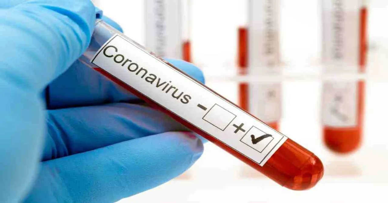 Covid 19 cases reached 23934 in Vadodara after 42 new cases on Wednesday