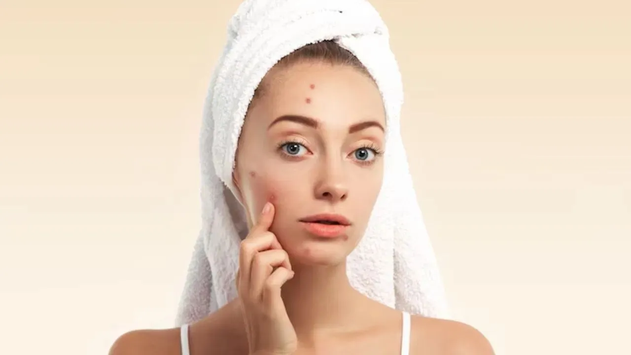 REMOVE PIMPLES