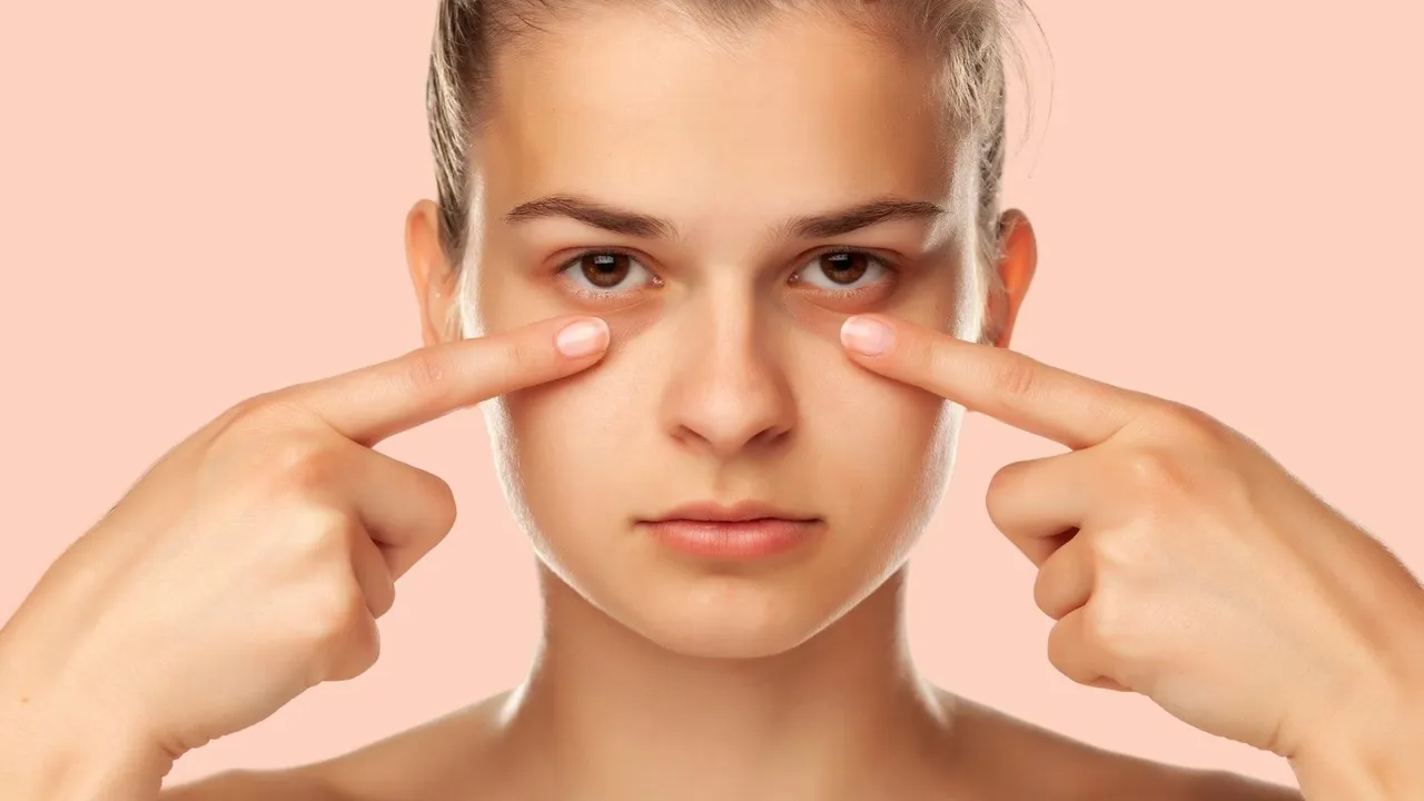 eyes-dark-circles