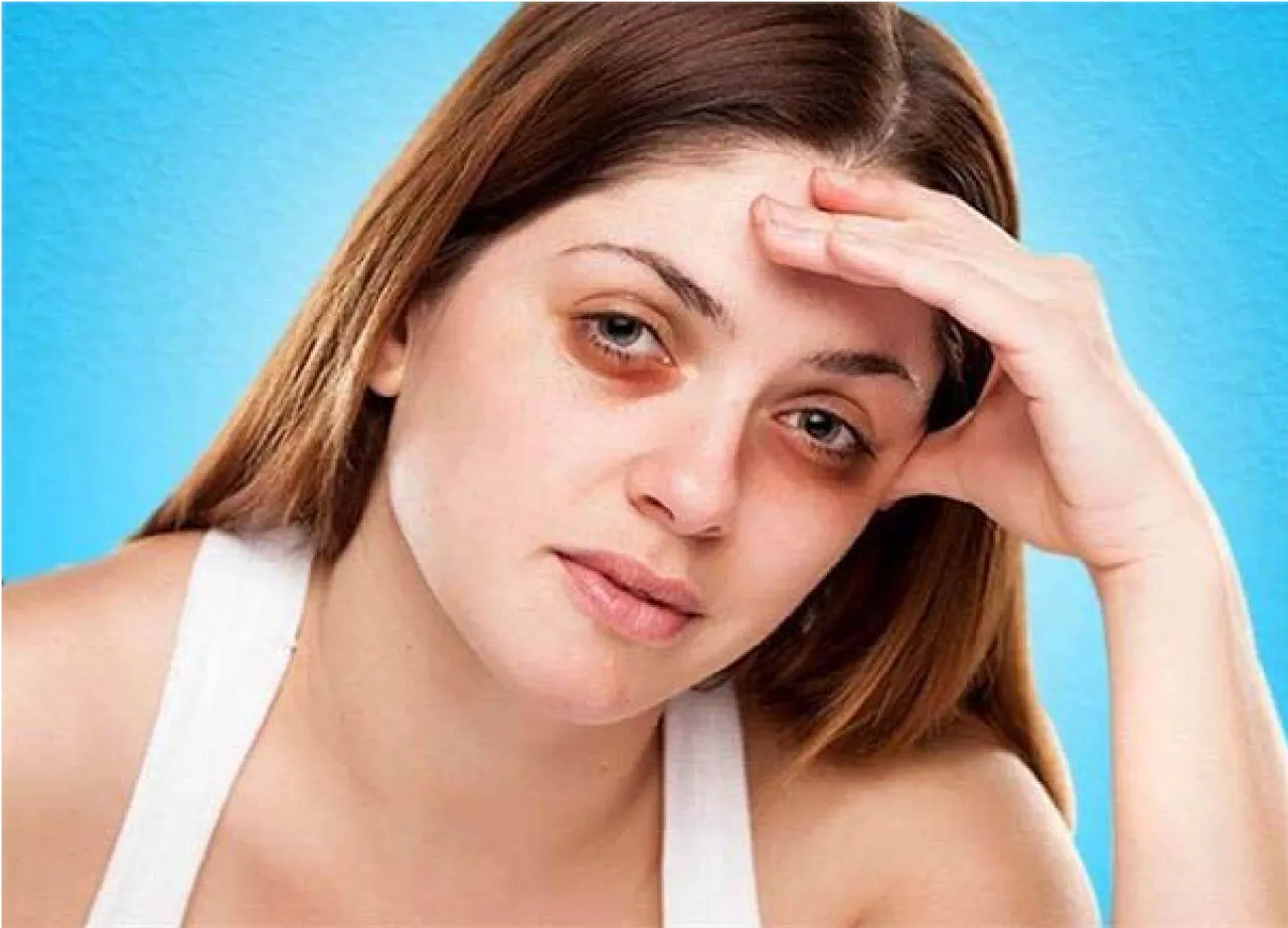 ડાર્ક સર્કલ 