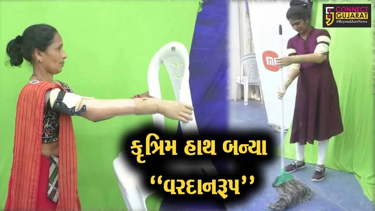 સુરેન્દ્રનગર : દિવ્યાંગ બહેનો માટે ઇલેક્ટ્રોનિક કૃત્રિમ હાથ વિતરણ કેમ્પ યોજાયો, નિઃશુલ્ક કૃત્રિમ હાથ ફીટ કરાયા...