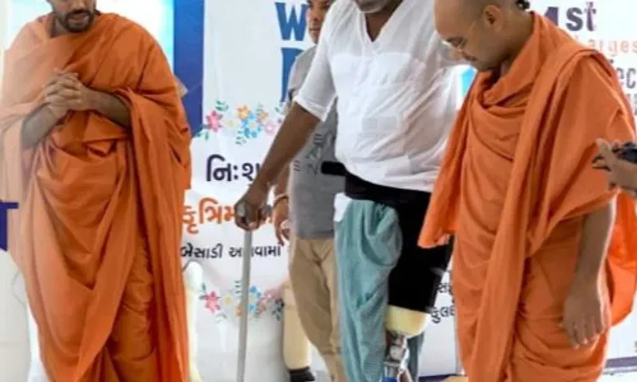 સુરત : નિ:શુલ્ક કૃત્રિમ હાથ-પગ બેસાડી આપવા માટેના કેમ્પનું સ્વામિનારાયણ ગોકુલધામ-નાર દ્વારા આયોજન