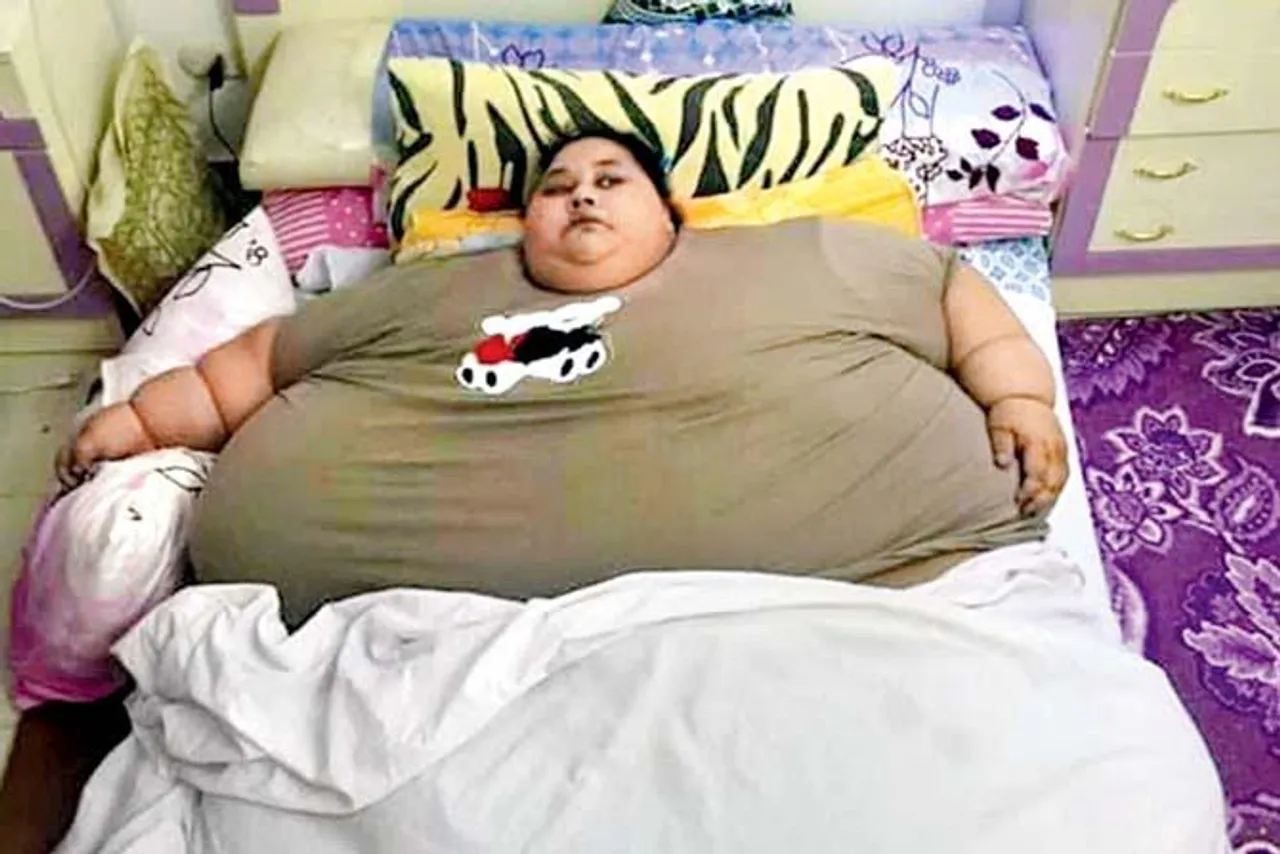 વિશ્વની સૌથી ભારે મહિલાનું ઓપરેશન બાદ વજન 242 કિલો થયુ