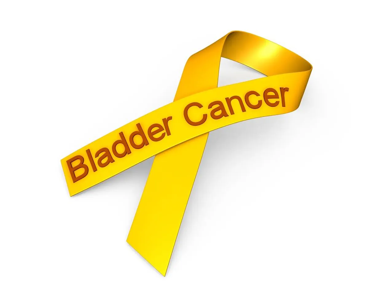 જાણો બ્લેડર કેન્સર થવાના કારણો અને લક્ષણ વિશે