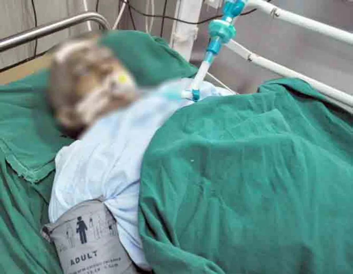 વાપીમાં હીટ એન્ડ રન : મોર્નીંગ વૉક કરતા દંપતીને રિક્ષાએ ઉડાવ્યું, પતિનું મોત