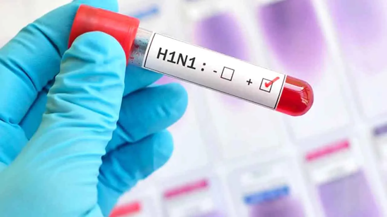 રાજકોટમા સ્વાઈનફલુનો કહેર યથાવત કુલ મૃત્યુ આંક 91 પર પહોચ્યો