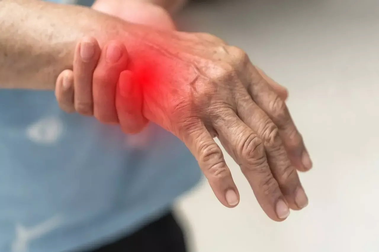 Gullain Barre Syndrome 