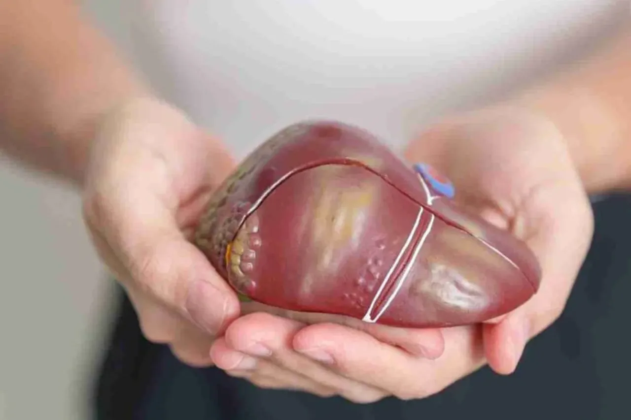 Fatty Liver