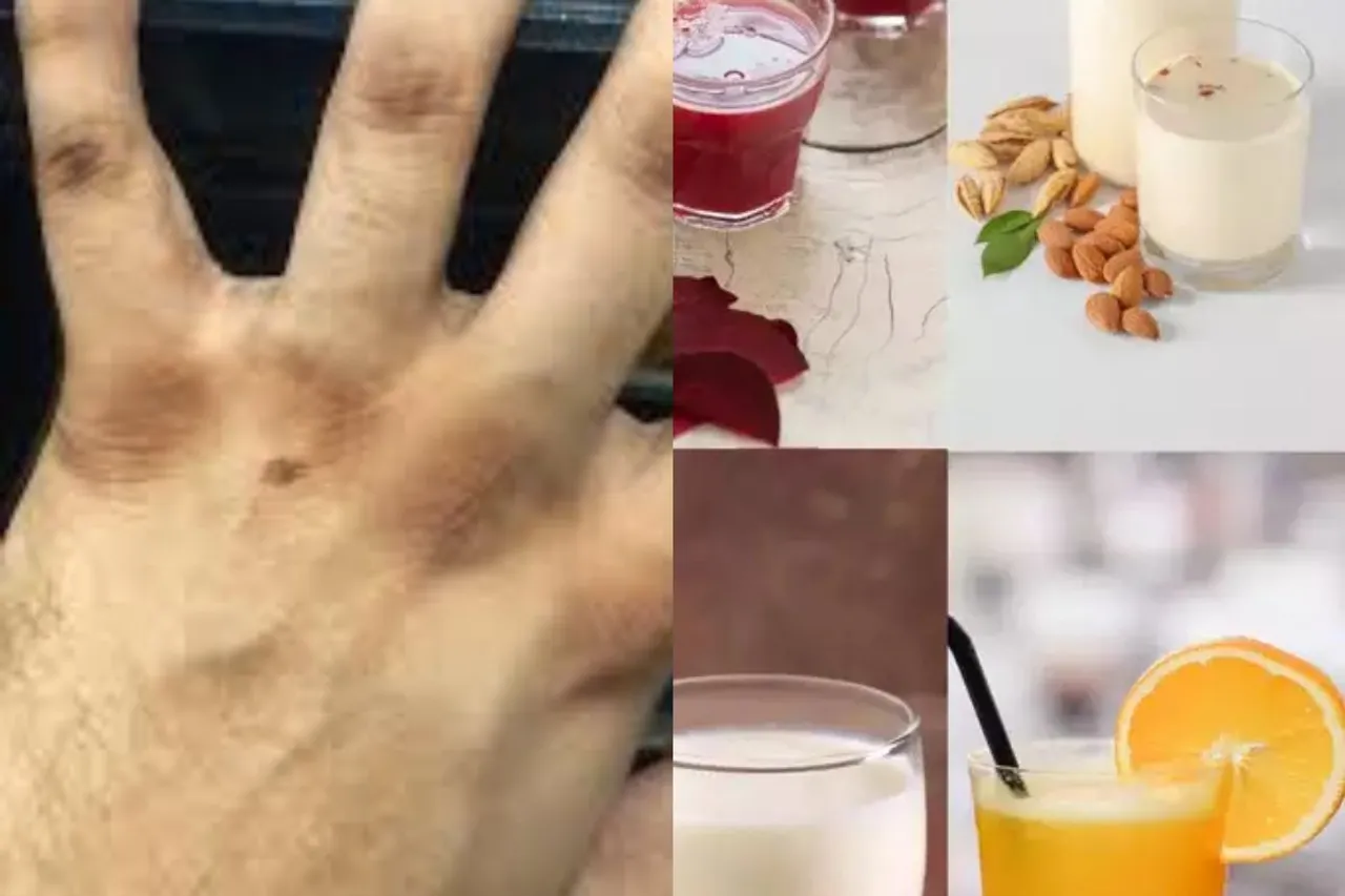 Vitamin B 12