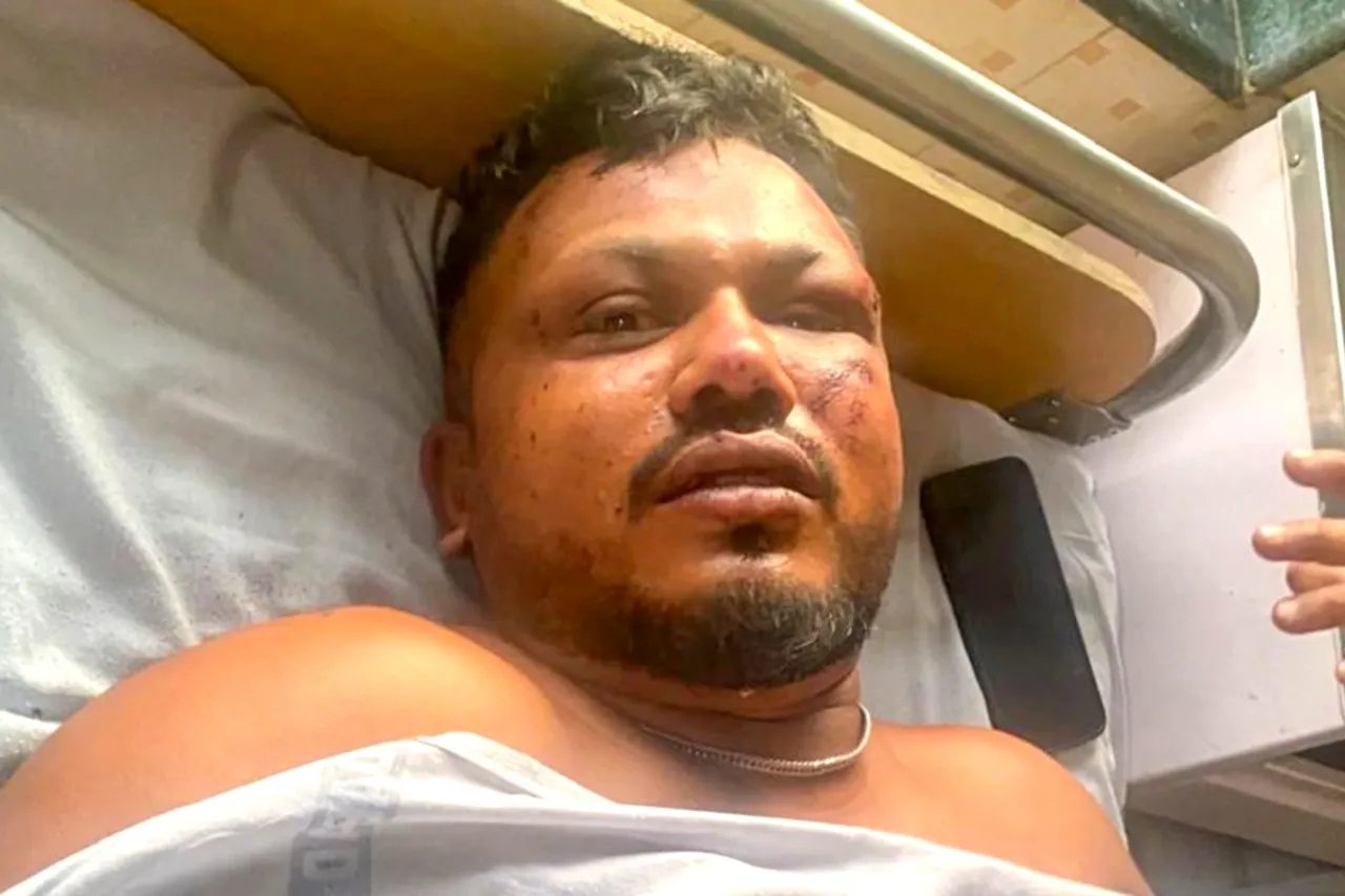 Ahmedabad Plane Crash Survivor Vishwash Kumar 